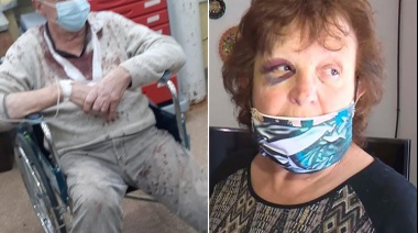 Brutal asalto a un jubilado de 75 años de La Plata: los golpearon y le destrozaron la casa con un martillo